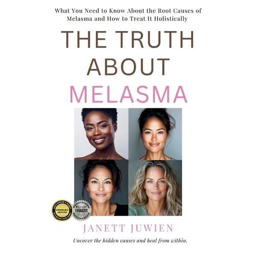 The Truth About Melasma: What You Need to Know About the Root Causes of Melasma and How to Treat It Holistically