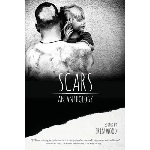 Scars: An Anthology