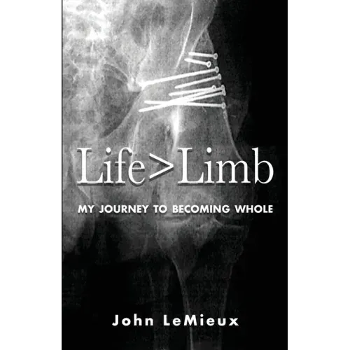 Life is Greater Than Limb: My Journey to Becoming Whole