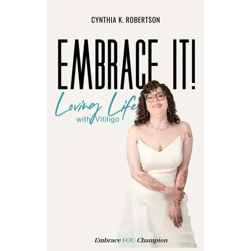 Embrace It: Loving Life with Vitiligo