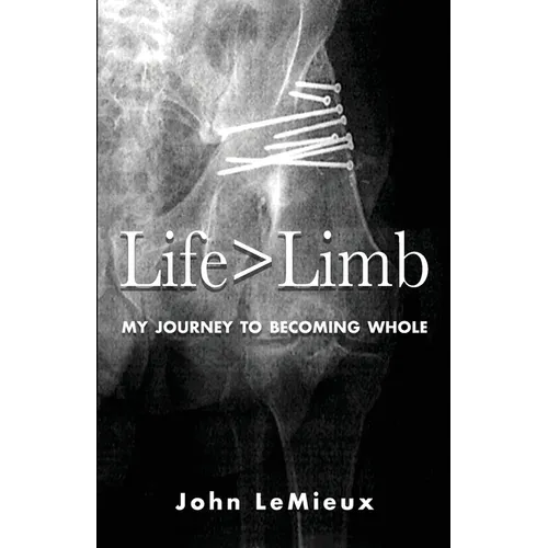 Life is Greater Than Limb: My Journey to Becoming Whole