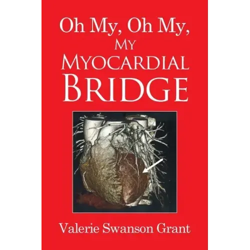 Oh My, Oh My, My Myocardial Bridge