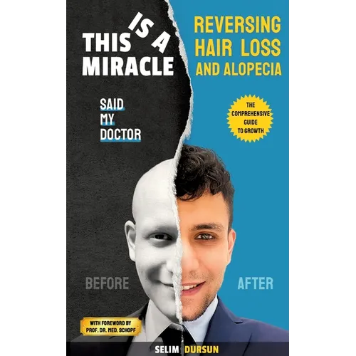 This Is a Miracle Said My Doctor: Reversing Hair Loss and Alopecia