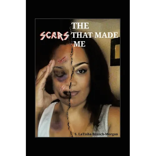 The Scars That Made Me
